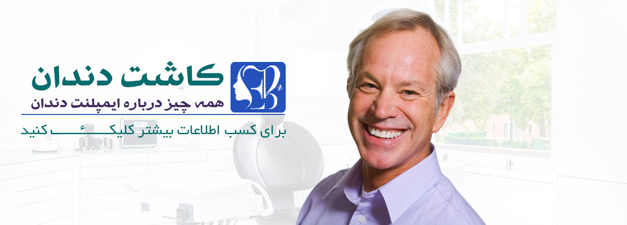 ایمپلنت دندان لیزری - جراحی ایمپلنت با لیزر